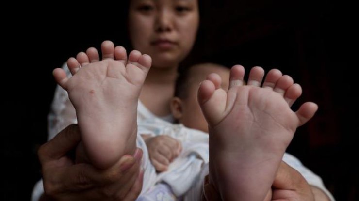 НЕВЕРОЯТНО! В Китае народился малыш у которого 31 палец и 4 ладошки (ФОТО)