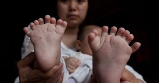 НЕВЕРОЯТНО! В Китае народился малыш у которого 31 палец и 4 ладошки (ФОТО)